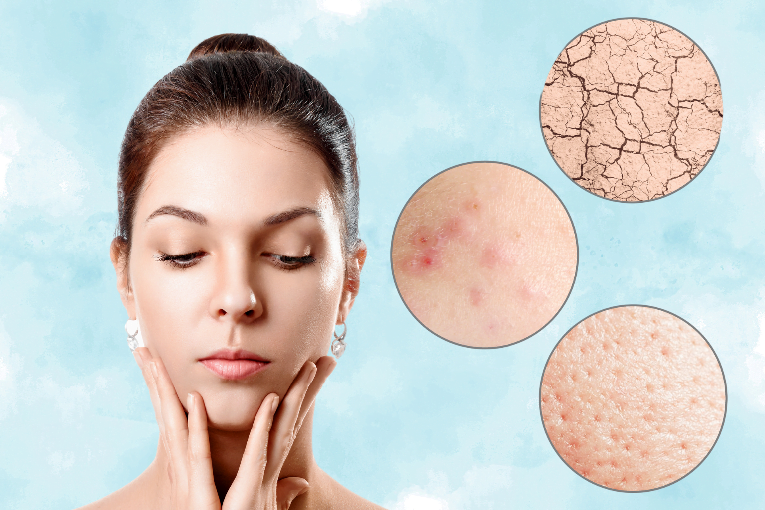 which moisturizer is best for dry skin