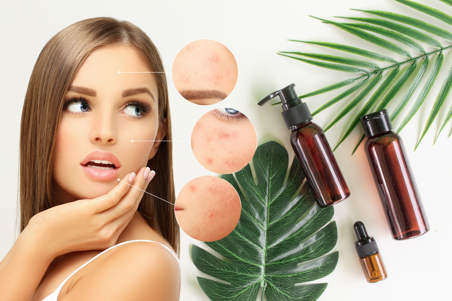 How to get rid of acne scars naturally