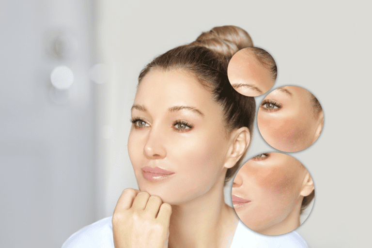 Signs of Damaged Skin Barrier – Protecting Your Skin