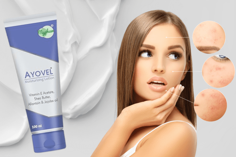 Which Moisturizer is Best for Acne Prone Skin – Clear Skin Ahead