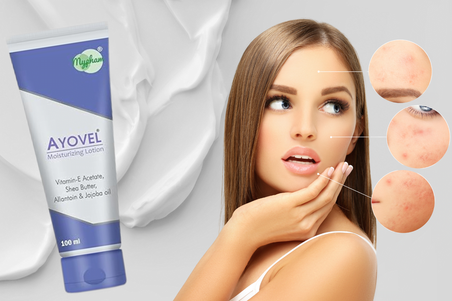 Which Moisturizer is Best for Acne Prone Skin