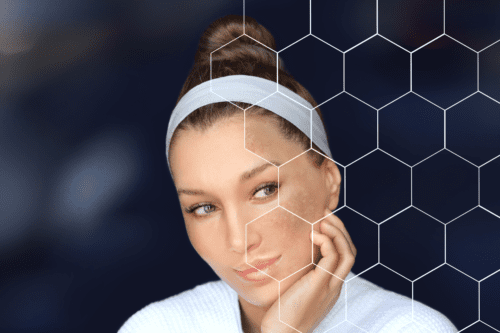 How to decrease melanin in skin, treatment for skin melanin